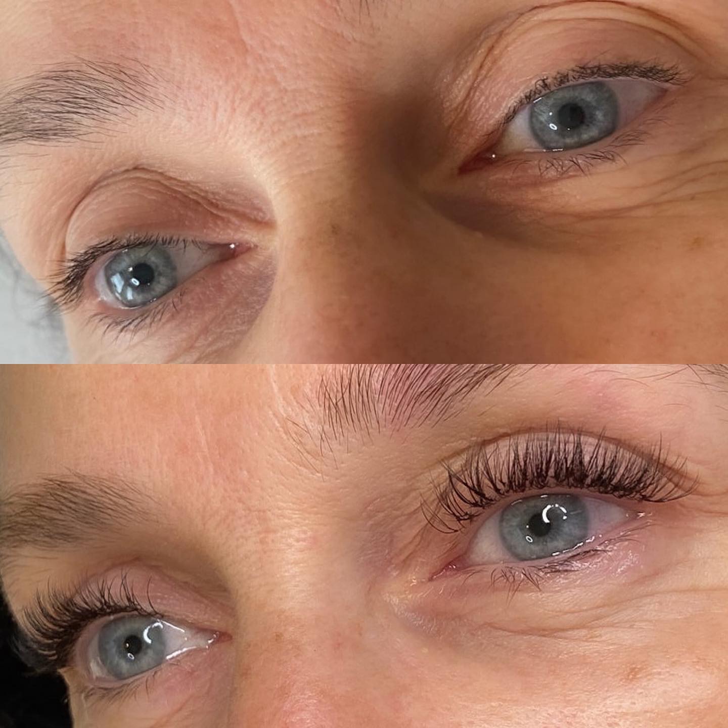 Avant/après extensions